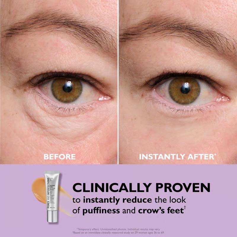 ðĨLast Day 49% OFFðTemporary Eye Tightener