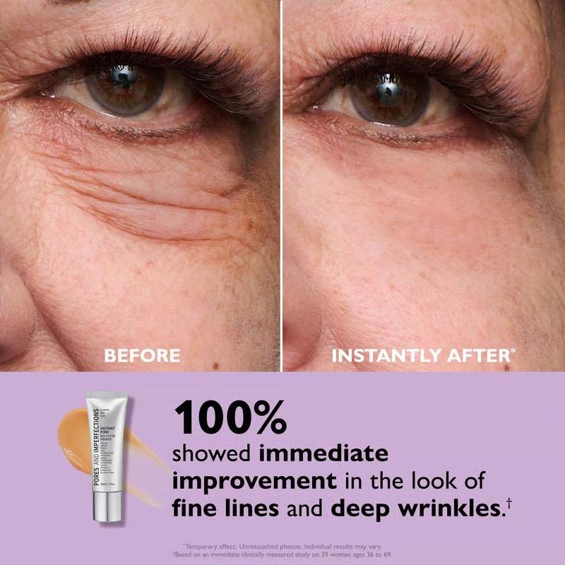 ðĨLast Day 49% OFFðTemporary Eye Tightener