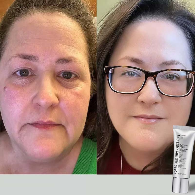 ðĨLast Day 49% OFFðTemporary Eye Tightener