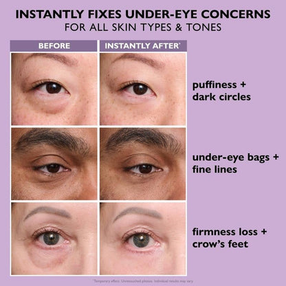 🔥Last Day 49% OFF🎁Temporary Eye Tightener