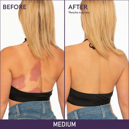 🎉Last Day Special Price🔥Evanesce Soft Matte Cream Concealer