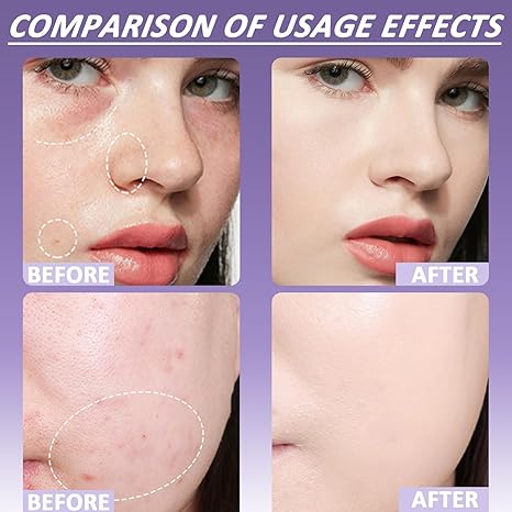 🎉Last Day Special Price🔥Evanesce Soft Matte Cream Concealer