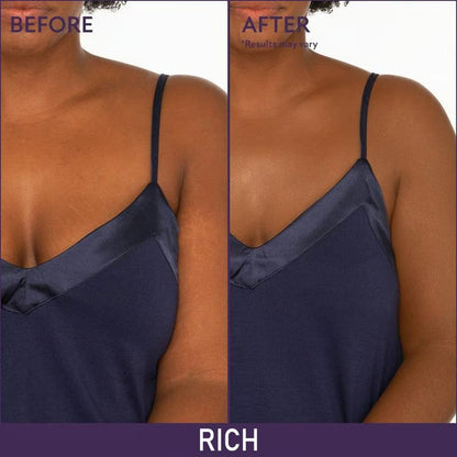 🎉Last Day Special Price🔥Evanesce Soft Matte Cream Concealer