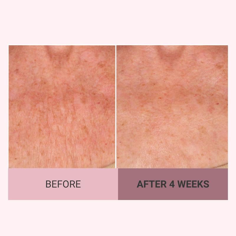 💆‍♀️ Experience Ultimate Luxury - 49% OFF - ✨ Champagne Beaute Lift Firming Body Crème - For Firmer, Smoother, Radiant Skin! 🌟