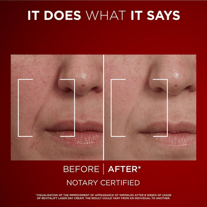 ✨HOT SALE 49% OFF🌿Eye Bag Instant Eraser, Tightens, Firms, & Blurs Wrinkles