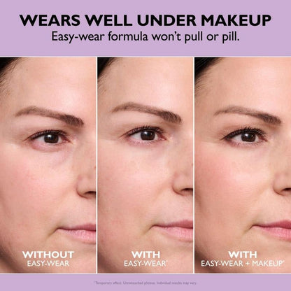 🔥Last Day 49% OFF🎁Temporary Eye Tightener