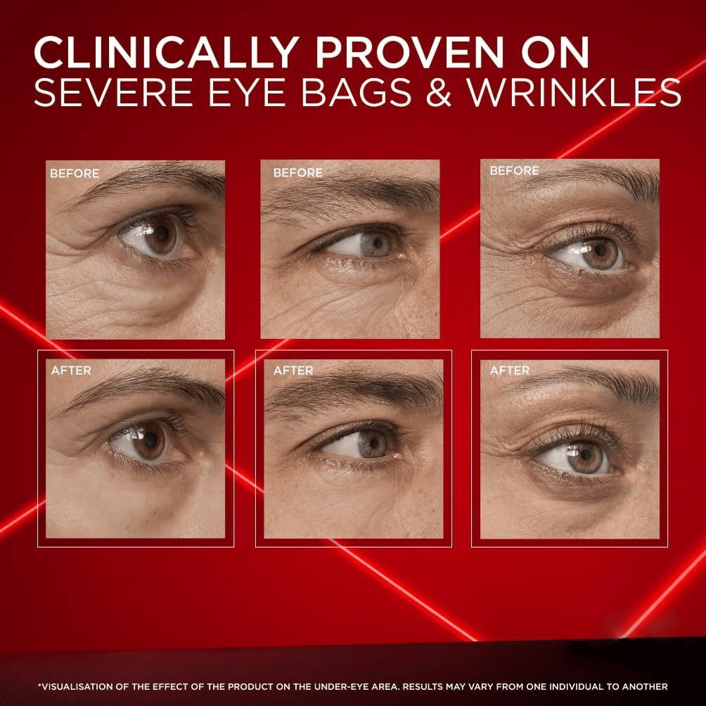 ✨HOT SALE 49% OFF🌿Eye Bag Instant Eraser, Tightens, Firms, & Blurs Wrinkles