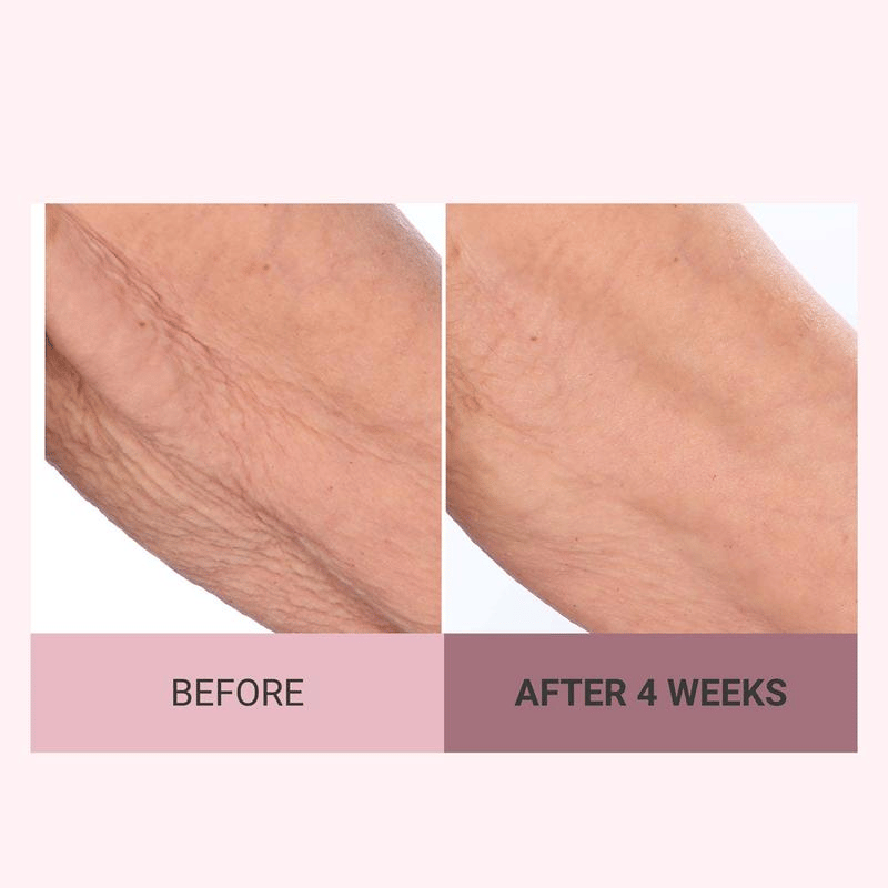 💆‍♀️ Experience Ultimate Luxury - 49% OFF - ✨ Champagne Beaute Lift Firming Body Crème - For Firmer, Smoother, Radiant Skin! 🌟