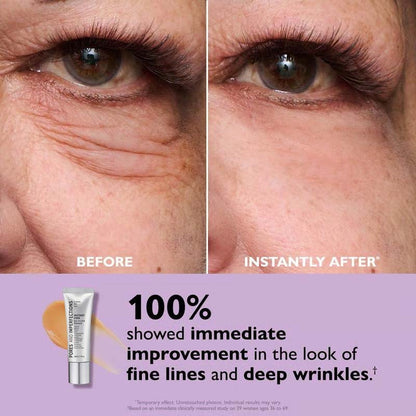🔥Last Day 49% OFF🎁Temporary Eye Tightener